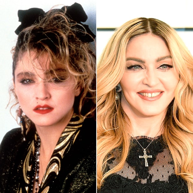 madonna face lift