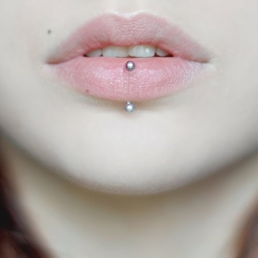 vertical labret scar