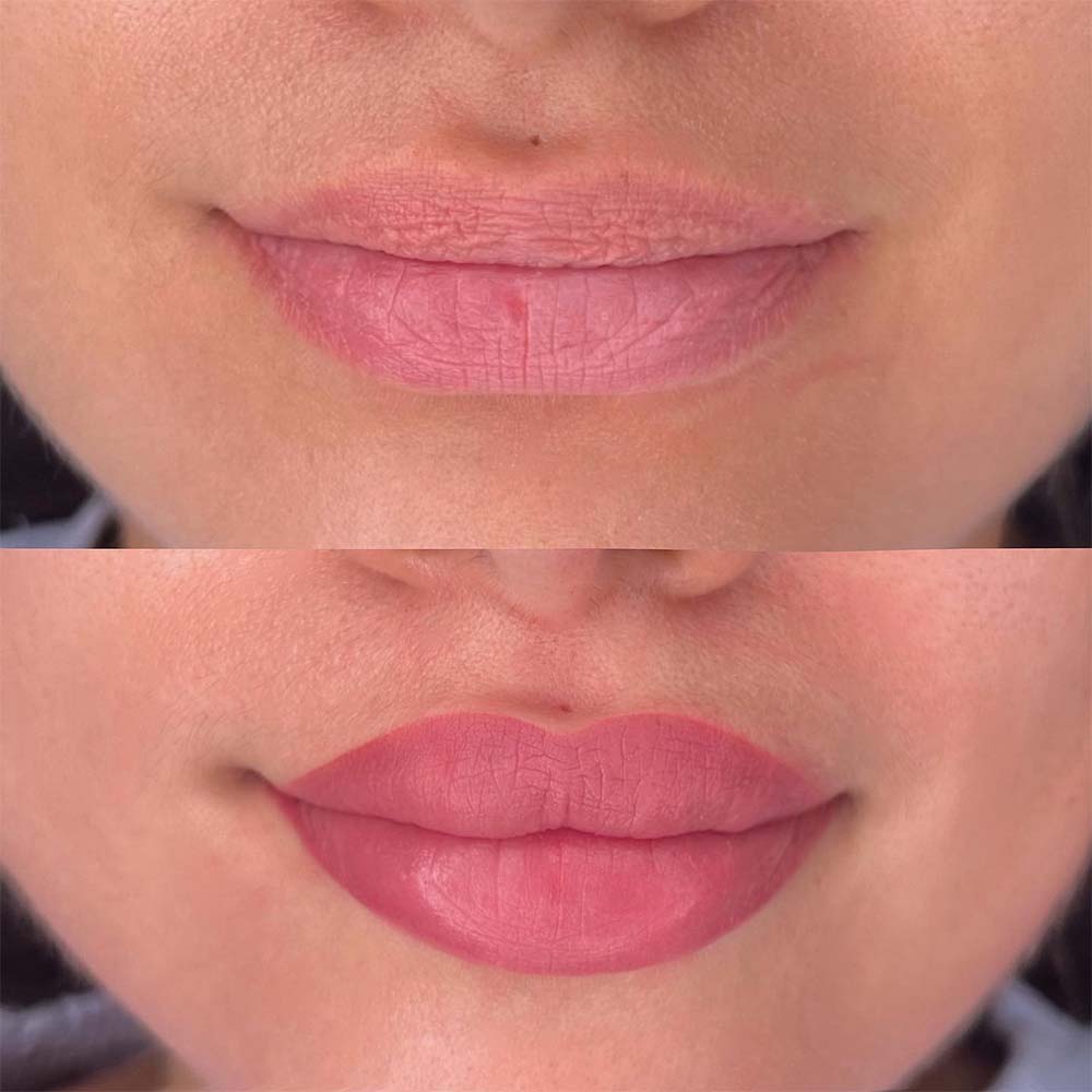 how to get bigger lips naturally